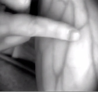 Ochelarii inteligenti permit asistentelor sa vizualizeze vasele de sange Smartglasses veins