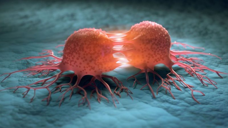 Descoperire de excepție după ce 18 pacienți care au urmat o schemă terapeutică au reușit să scape de cancerul rectal avansat Descoperire de excepție după ce 18 pacienți care au urmat o schemă terapeutică au reușit să scape de cancerul rectal avansat