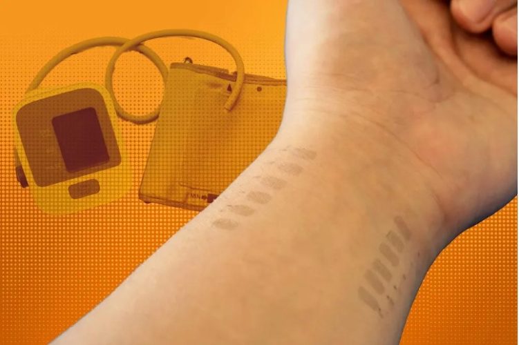 Tatuajul electronic, înlocuitorul tensiometrului