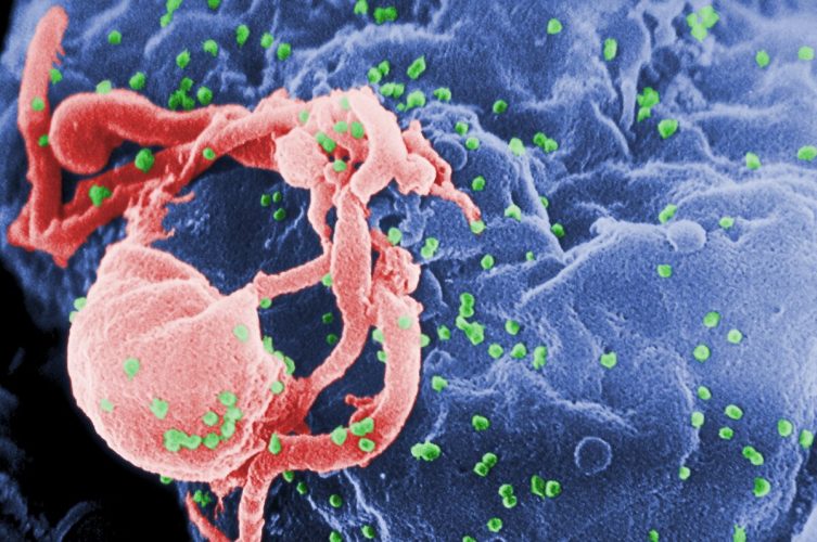 Foto virus HIV